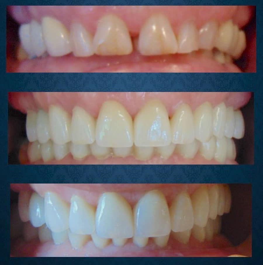 Before after photo1